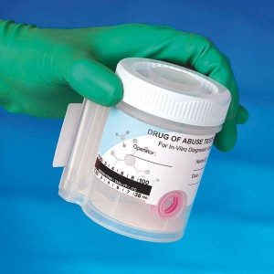 Alcohol- en Drugstesten