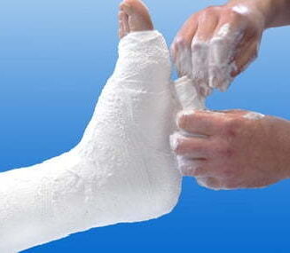 Gipszwachtel NOBAFORM. 3m