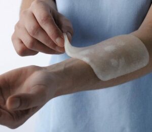 Voor een effectievere eerste hulp bij brandwonden